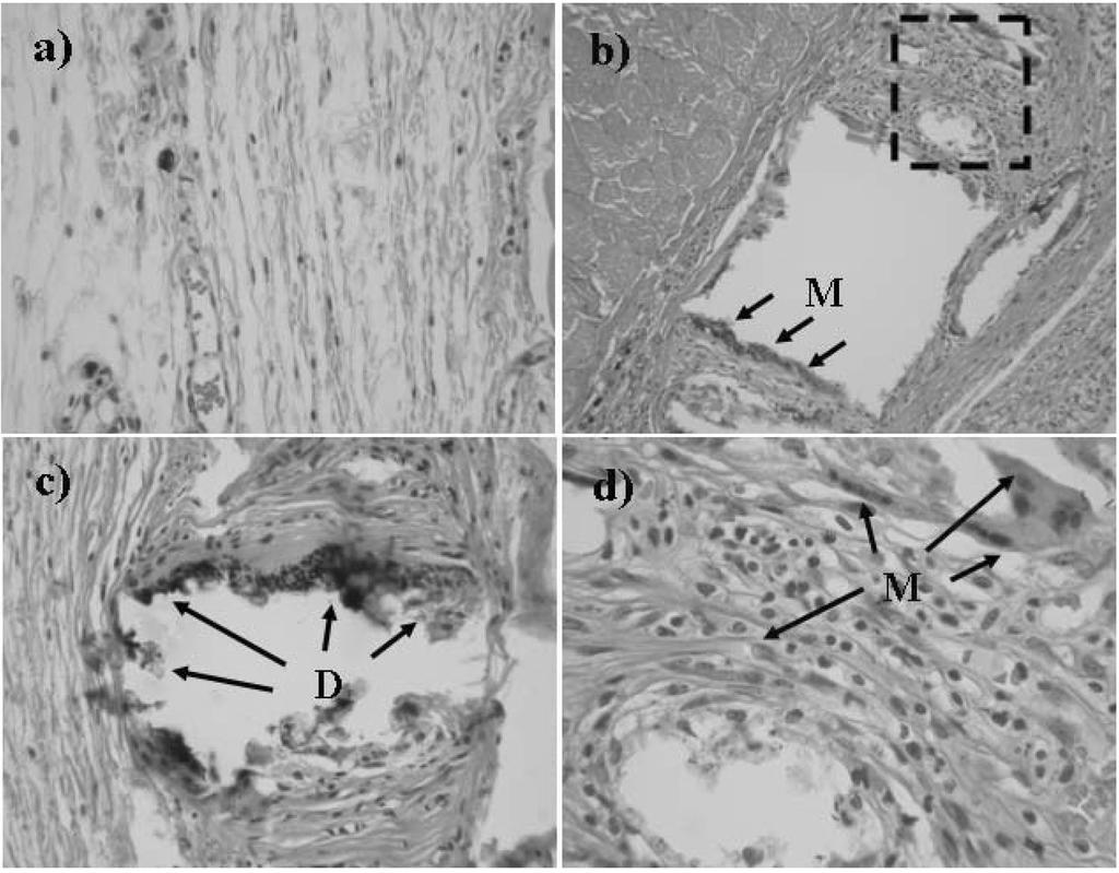 대식세포가 β-tricalcium Phosphate 뼈이식제의 생분해에 미치는 영향 Fig. 6. 623 Histological findings (H&E stain) of subcutaneous tissue implanted with porous β-tcp granule.