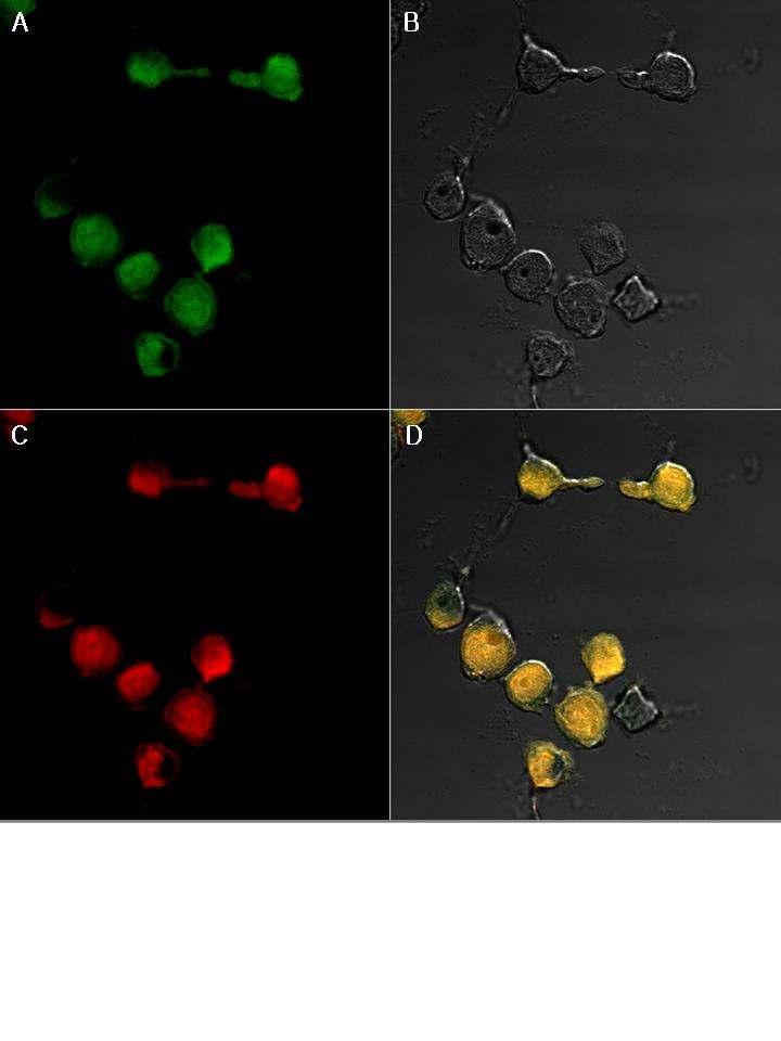 Fig. 21. Morphological change of nuclear chromatin in HepG2 was viewed under a fluorescence microscopy (X100) on 24 (upper) and 48 hrs. (bottom).