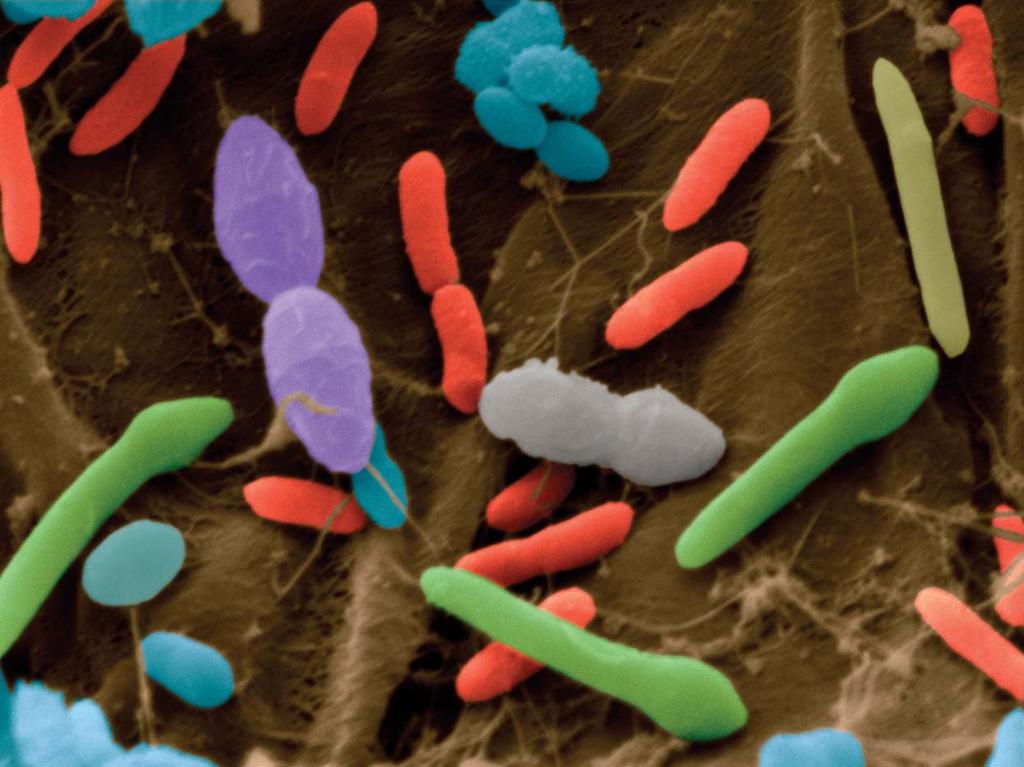 3. Microbial World - Microbes are extremely diverse - inhabit