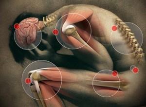 체성통증 (Somatic Pain) A type of nociceptive pain Area : the Skin & Deep tissues 통증양상 Aching ( 쑤시는, 아리는 ) Constant ( 거듭되는 ) Dull ( 둔한 ) or sharp ( 날카로운 ) 움직임 (movement) 시통증악화