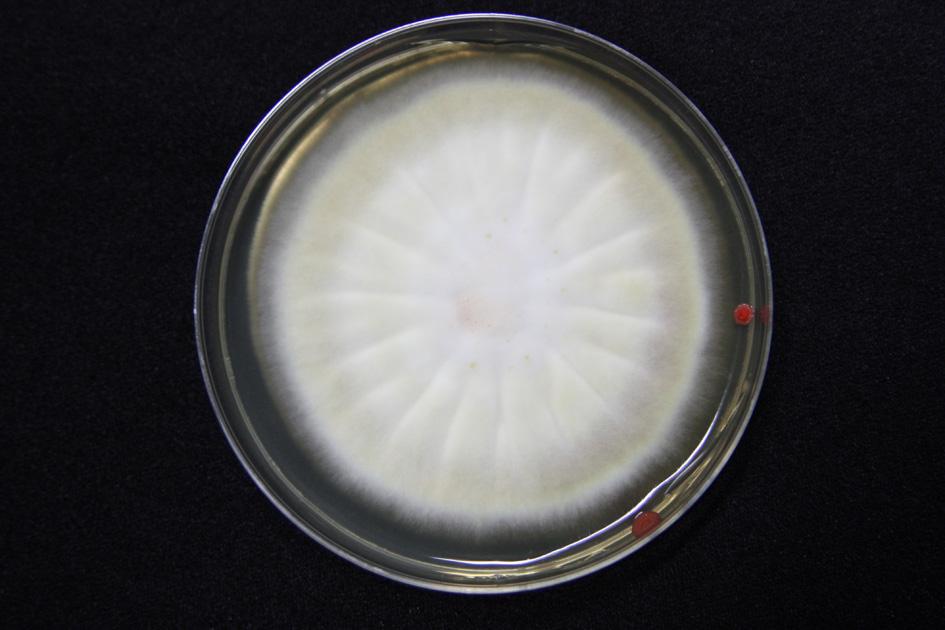 Fig. 2. Colony is white, cottony on Sabouraud dextrose agar after 2 weeks at 25. Fig. 4. Fungal hyphae in the keratin layer (PAS, 200). 로병변이호전되었다. 증례 2 Fig. 3.