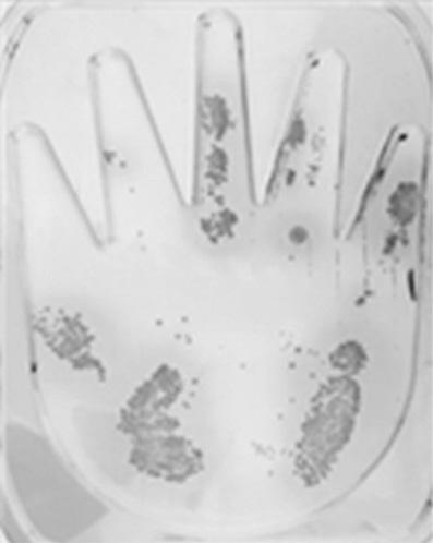 J Dent Hyg Sci Vol. 17, No. 6, 2017 트는핸드플레이트 (S. epidermidis test plate; B&F) 와지름 6.0 cm 두께 1.5 cm, 표면적 25 cm 2 의로닥플레이트 (S. epidermidis test plate; B&F) 를이용하였고, 배지조성은 peptone, 10.