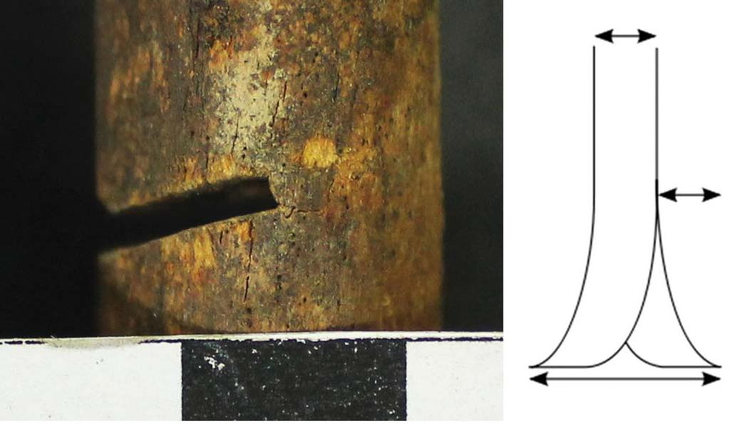 Note the kerf be considered as protruded teeth of wobbling saw blade just like the alphabet M on the cut mark of bone. (Fig. 4).