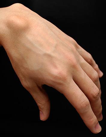 Ganglion