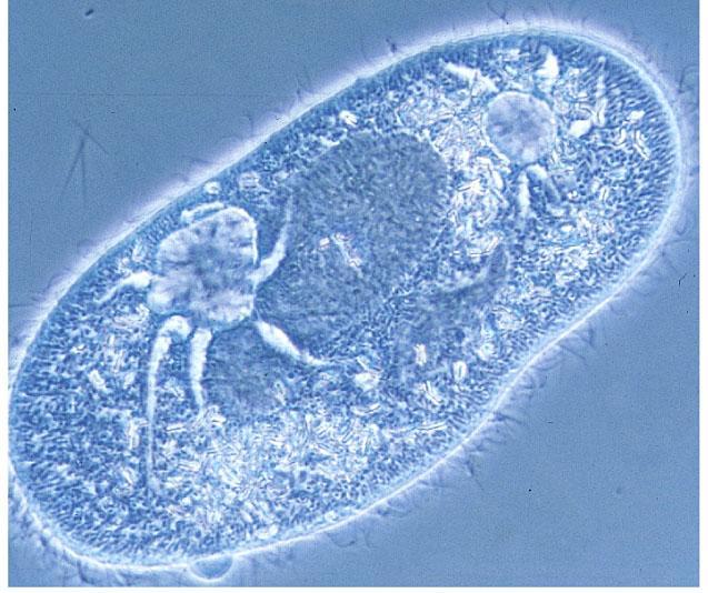 Contractile vacuoles ( 수축포 ), found in freshwater protists, pump