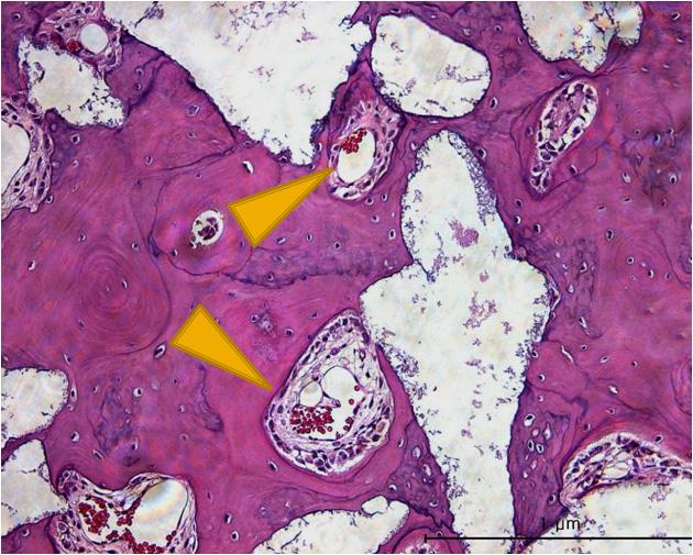 (a) low magni fication (b) Cuboidal osteoblast (yellow