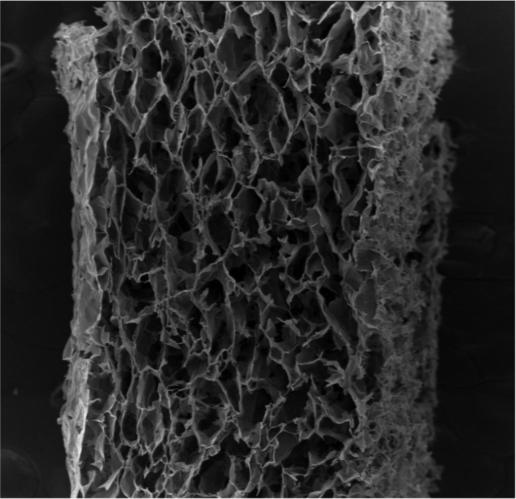 Guided Bone Regeneration using Cross-linked Type-I Collagen Membrane 보이는 것으로 생각된다. 하지만 흡수성 콜라겐 차폐막 자체의 강도가 낮고, 대식세포, 다형핵백혈구와 같은 효소와 치주조직에 존재하는 박테리아에 의한 흡수가 빠르다는 단점이 있다.