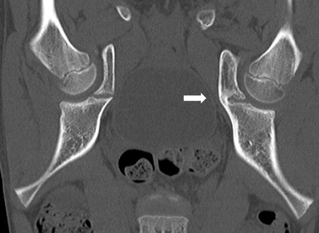 (A) It is an axial view of the computed tomography (CT).