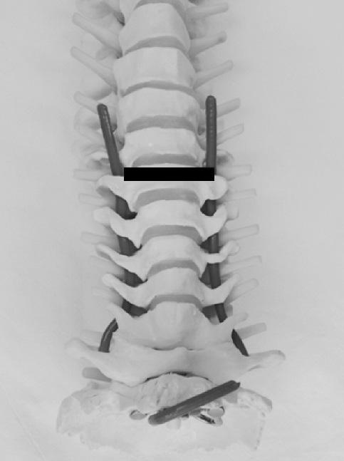 thyroid gland (Th) in midline. () Position of probe for () on the artificial spine model.