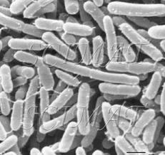 (4) 분변미생물 Enterobacter Escherichia 위, 소장, 대장등에는각각다른세균이미생물균총을형성하여서식