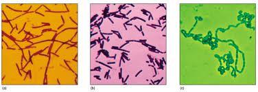 (2) 락토바실러스 (Lactobacillus) 속 미호기성이며운동성이없고색소를생성하지않는무포자균 젖당을분해하여젖산을생성하는젖산균 (Lactobacillus균) 젖산균은유익한세균이많은데, 특히 L. bulgaricus, L.