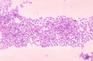(3) 마이크로카커스 (Micrococcus) 속