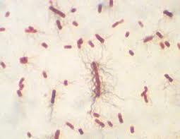(6) 프로테우스 (Proteus) 속 통성혐기성이고장내세균과에속함 단백질분해력이강하여육류의부패균으로잘알려져있음 P.