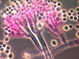 (Bacteria) 곰팡이 (Fungi) 효모