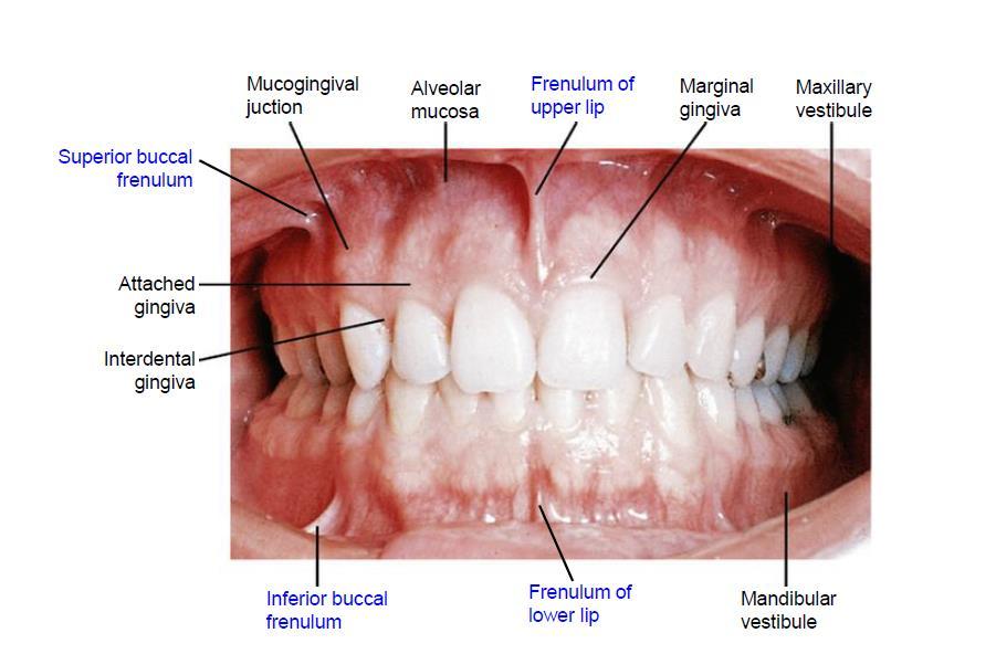 1) Oral vestible은치아, 입술, 볼사이의좁은공간 2) Oral vestible은뒤쪽으로 second superior molar tooth가있는곳에서 parotid duct의개구부가있다.