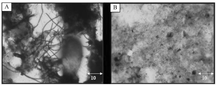 < 그림 5> 광학현미경을활성슬러지의관찰 : (A) 초음파처리전, (B) 2 분간 1.5kWdml 전력과 20kHz 의주파수로초음파처리한후.