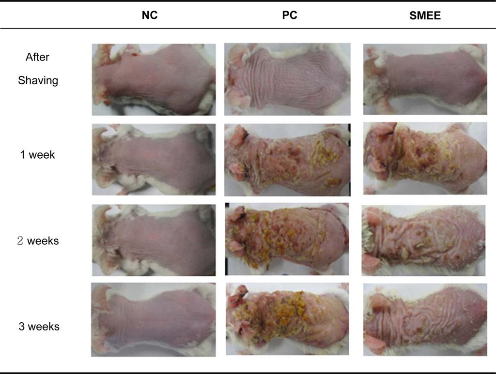 86 Jeong et al. Fig. 4. Effects of Sargassum micracanthum ethanol extract on total lge production in sera from atopic dermatitis-like skin lesions mice.