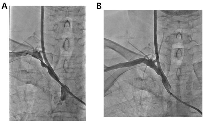 Korean J Clin Lab Sci. Vol. 49, No. 3, September 2017 319 Figure 3. Duplex sonography in left carotid arteries.