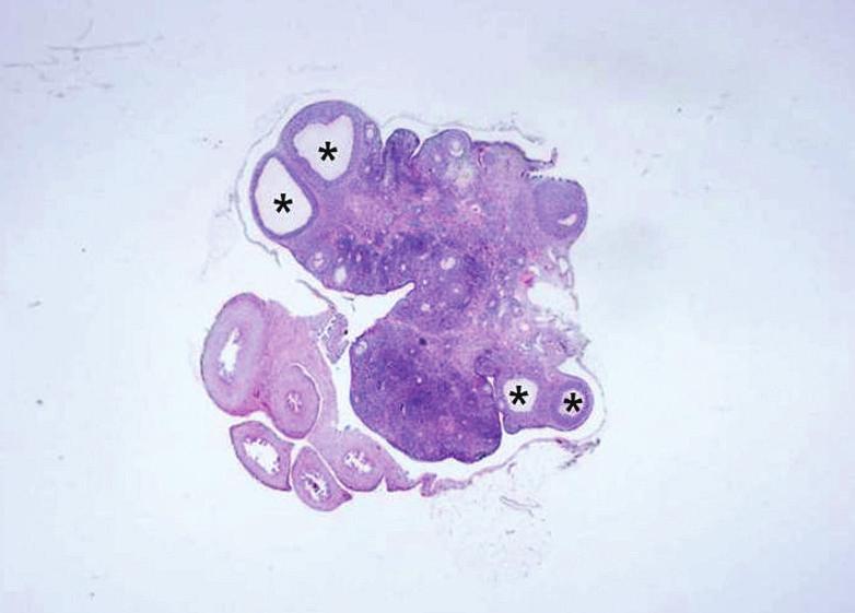 . Fig. 4. Higher magnifi cation of the ovary, letrozole-treated group. Many cystic follicles (asterisks) consisted of luteinized theca cells are noted.