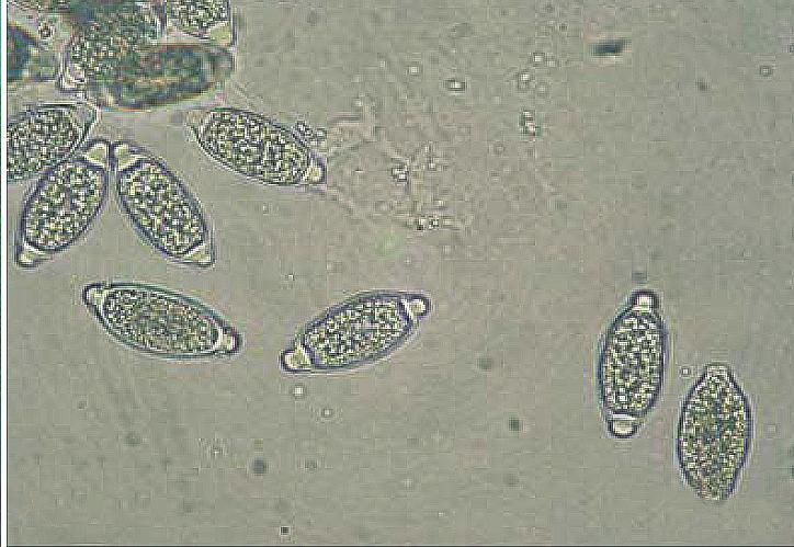 (A, B) Adult worms and eggs of Trichuris trichiura. (C) Anisakis sp. larva. (D) Adult worms of Enterobius vermicularis.