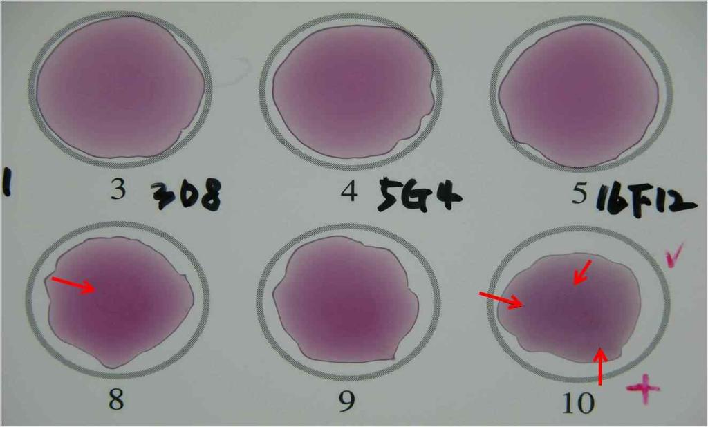 간흡충충란특이항체 - 금입자결합체와간흡충충란과의반응성확인 m 항체-라텍스입자축합체제조 ( 그림 11, 12) - 단클론항체의준비