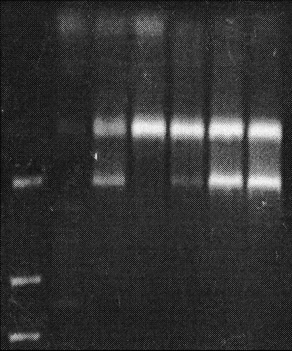 ARK1 GAPDH Fig. 4. RT-PCR sample of patients.