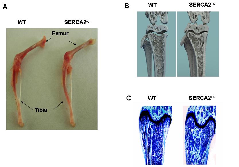 Fig. 4. Bone morphology and bone density of SERCA2 +/- mice compared to wild-type. (A) No difference considering tibial bone length and morphology was found between SERCA2 +/- and wild-type mice.