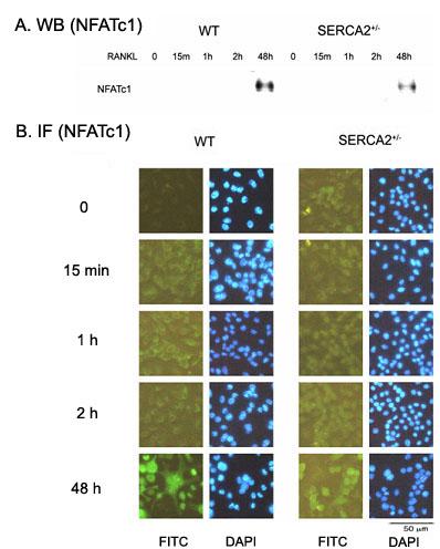 Fig. 9. NFATc1 expression and nuclear translocation stimulated by RANKL. (A) NFATc1 was expressed 48 hrs after RANKL stimulation in both SERCA2 +/- and wild-type mice.