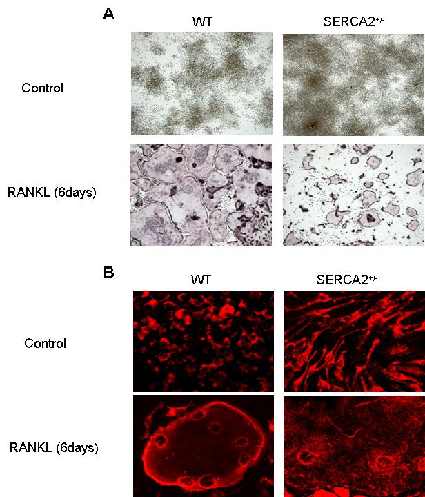 Fig. 10. Differentiation into multinucleated osteoclasts by RANKL stimulation. (A) TRAP staining was performed 6 days after RANKL stimulation.