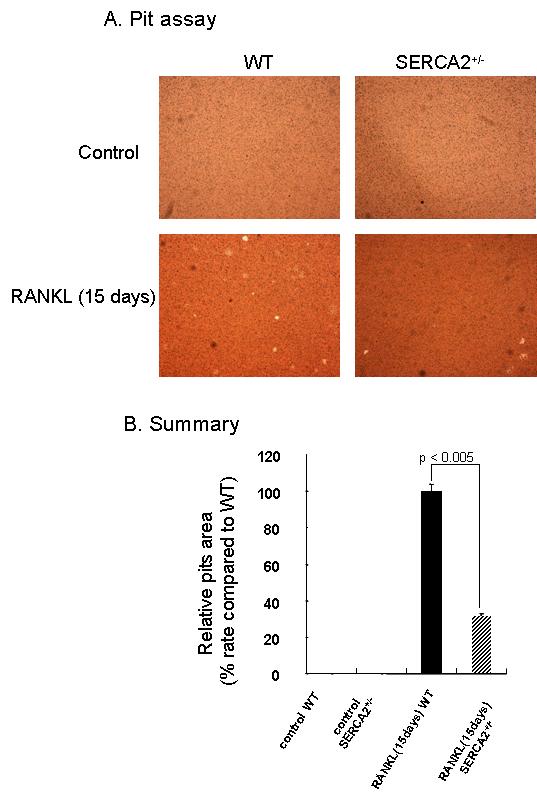 Fig. 11. Bone resorbing activity of osteoclasts. (A) Pit Assay was performed 15 days after RANKL stimulation.