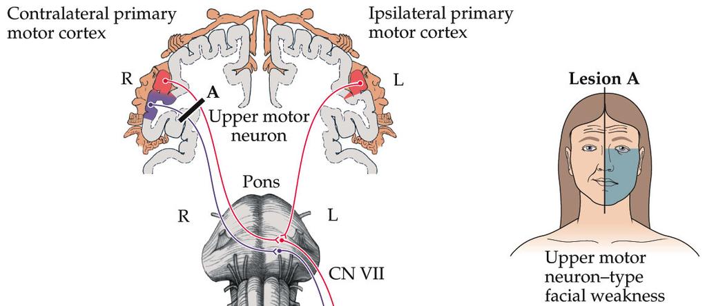 Facial motor nucleus( 안면신경운동핵 ) >-- 대뇌