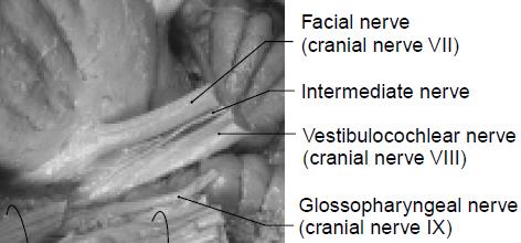 VIII. Vestibulocochlear nerve( 전정달팽이신경 ) inner ear 특수감각전달하는감각신경두 part