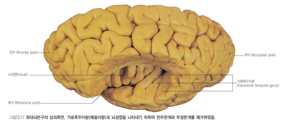 외측틈새 ) 깊숙이위치 Heschl s gyrus(transverse temoral gyrus,