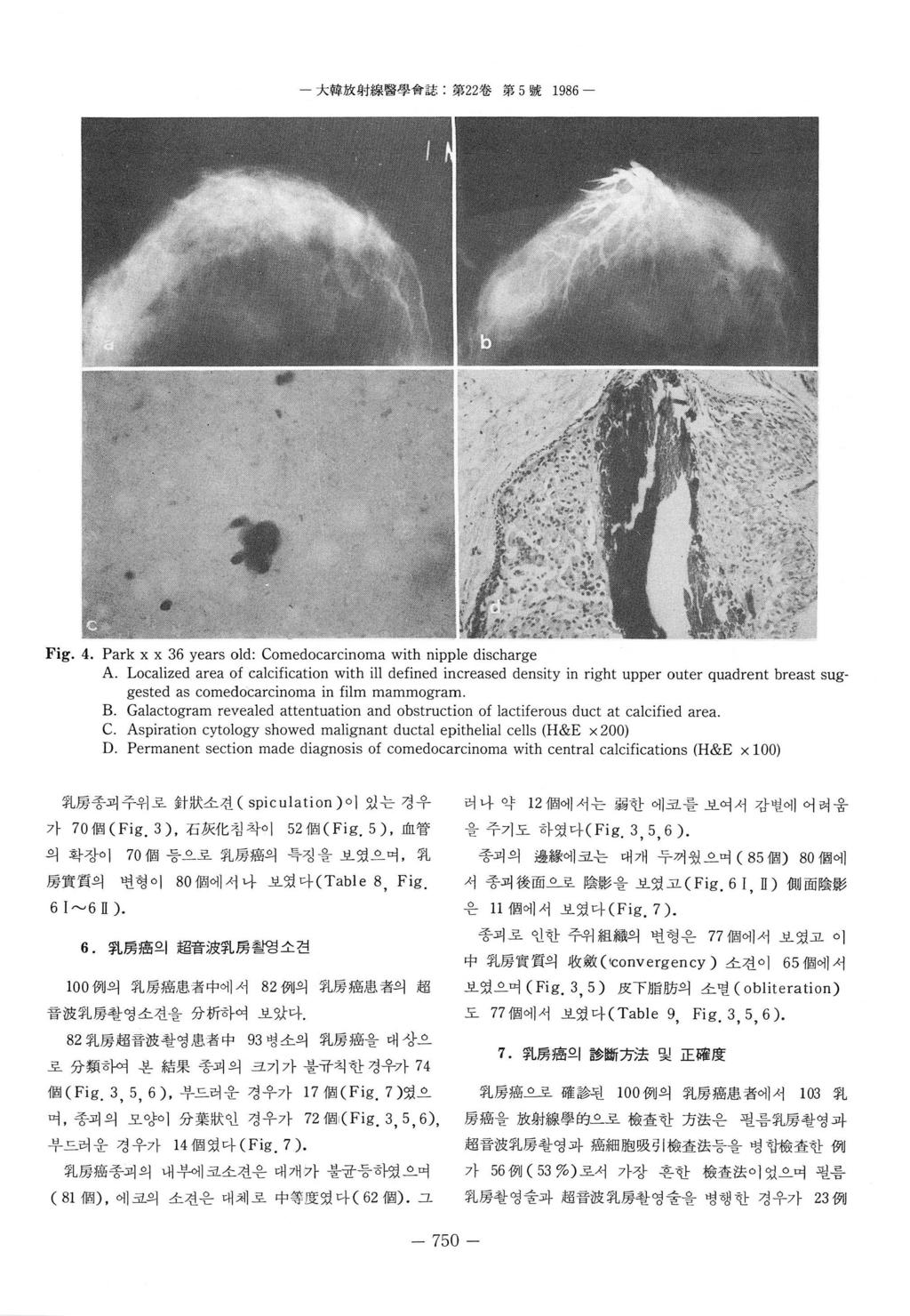 - 大짧放射緣醫學會誌 : 第 ~ 第 5 號 986 - Fig.. Park x x 6 years old: Comedocarcinoma with nipple discharge A.