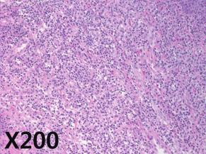 double staining showed majority of EBV-positive cells are positive for CD79a (