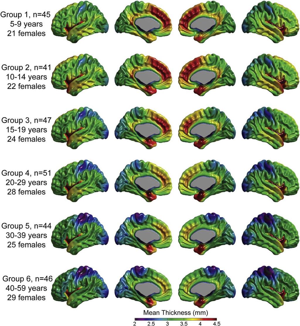 Result (Figure1) 그룹별뇌두께변화가시화 결과 : 나이에따른뇌의두께변화 그룹분할방법 나이 (age) 의순서에따라서사람숫자 (n) 가균등하게분포