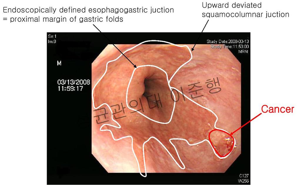 Endoscopic findings