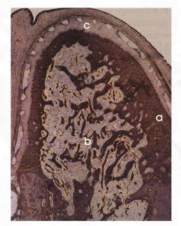 골조직의조직구분 a. 치밀골 ; 주로골세포층으로 b.