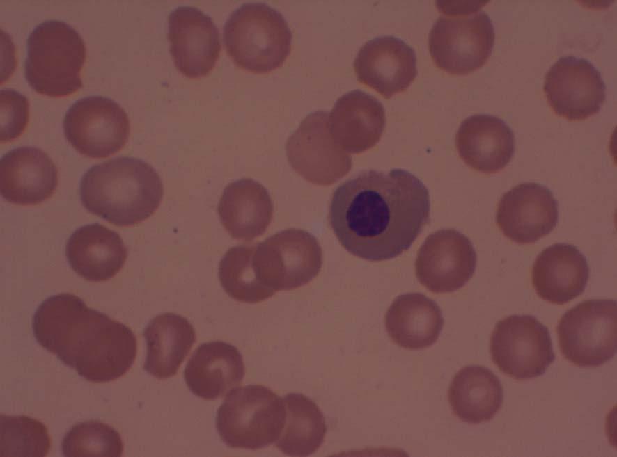 Figure 1. Photograph of peripheral blood smear.