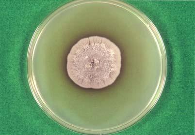 Fig. 4. Black gray velvety colony of S. schenckii on Sabouraud's dextrose agar at 25 for 3 weeks. Fig. 6.