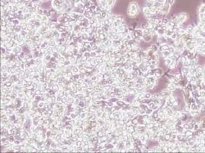 그림 5. 계대배양중인 RAW264.7 세포주의현미경사진 2.2.2. 시료처리 - 리나린 ( 리나린) 은 ChemFaces사에서순도 98% 로구입하여사용하였다.
