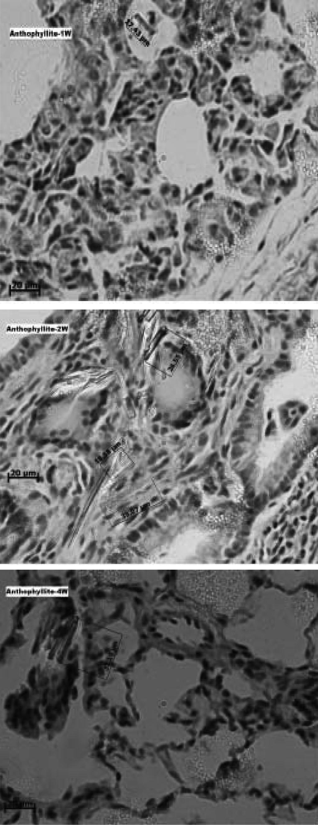 36 정용현, 한정희, 강민구, 김종규, 양정선 Ⅳ. 고 찰 Figure 7. A lot of anthophyllite fibers in the lung of SD rats instilled anthophyllite after,, weeks. H&E, x light microscopy.