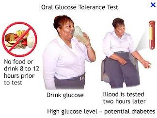 당뇨병 : 진단검사 9) 당부하검사 (glucose tolerance, GTT ; 경구당부하검사 oralgtt, OGTT) 1 당뇨진단에가장민감한검사 2