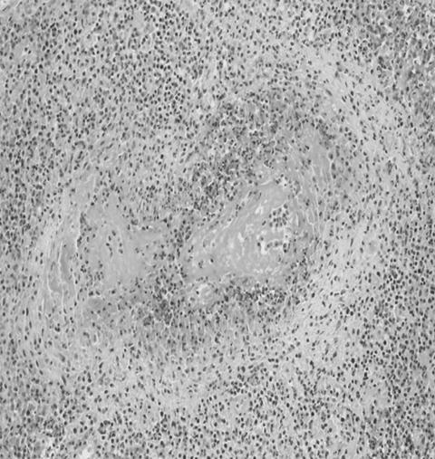 marked neutrophils and eosinophils were infiltrated at dermal area (C, 200). Figure 4.