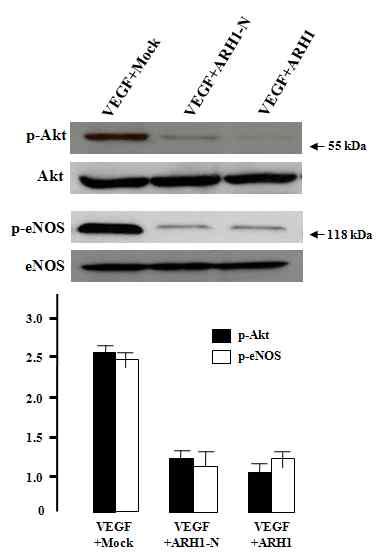 ARH1-N inhibits nuclear
