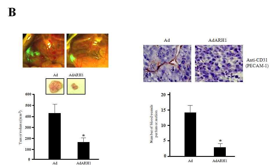 delivery of ARH1 inhibits tumor growth