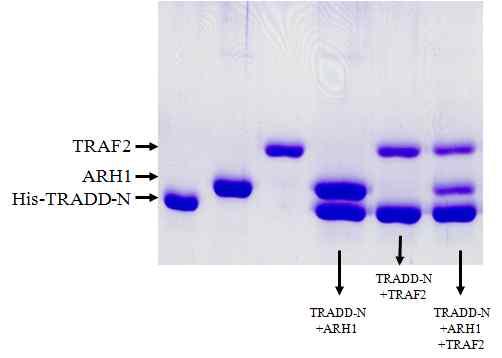ARH1 H-ras K-ras N-ras TRADD IP : anti-gfp WB : TRADD WB : ARH1 WB : beta-actin in WCL Figure 10. Interaction of TRADD with RAS family Figure 8.