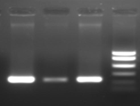 A-jin Lee, et al. : Mupirocin-Resistant S. aureus 21 Fig. 1. Bands of mupa gene in 3 high-level resistance of mupirocin. Lane 1, patient No. 162; Lane 2, patient No. 192; Lane 3, patient No.