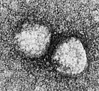 Fever ) = 돼지콜레라 Flaviviridae Pestivirus 에의해감염 감염시폐사율