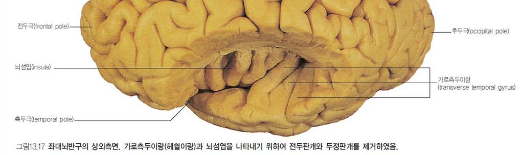 Primary auditory cortex( 일차청각피질 ) transverse temporal gyri( 가로측두이랑, Heschl s